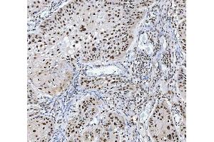 IHC analysis of MBNL1 using anti-MBNL1 antibody (ABIN7602608). (MBNL1 anticorps  (AA 89-388))