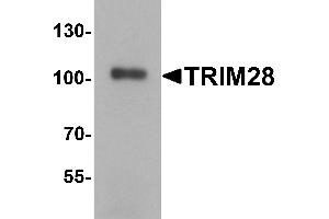 Western Blotting (WB) image for anti-Tripartite Motif Containing 28 (TRIM28) (C-Term) antibody (ABIN1077358) (KAP1 anticorps  (C-Term))