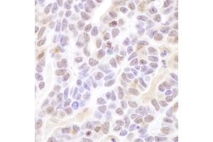 Immunohistochemistry (IHC) image for anti-Coilin (COIL) (AA 275-325) antibody (ABIN7454496)
