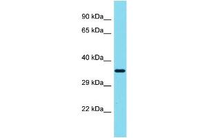 Host: Rabbit Target Name: SIAH3 Sample Type: MCF7 Whole Cell lysates Antibody Dilution: 1. (SIAH3 anticorps  (C-Term))