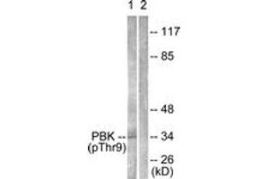 Western blot analysis of extracts from K562 cells treated with UV 30', using PBK/TOPK (Phospho-Thr9) Antibody. (PBK anticorps  (pThr9))