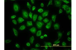 Immunofluorescence of monoclonal antibody to TUBB4B on HeLa cell.