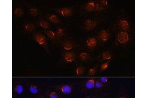 Immunofluorescence analysis of C6 cells using GOLGA4 Polyclonal Antibody at dilution of 1:100 (40x lens).