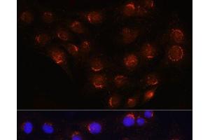Immunofluorescence analysis of C6 cells using GOLGA4 Polyclonal Antibody at dilution of 1:100 (40x lens). (GOLGA4 anticorps)