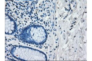 Image no. 1 for anti-Interferon Regulatory Factor 3 (IRF3) antibody (ABIN1498899) (IRF3 anticorps)