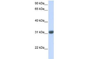 WB Suggested Anti-OTX2 Antibody Titration: 0. (OTX2 anticorps  (Middle Region))