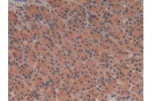 Detection of TUBd in Rat Stomach Tissue using Polyclonal Antibody to Tubulin Delta (TUBd)