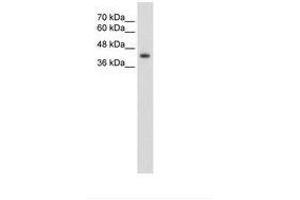 Image no. 3 for anti-GNAS Complex Locus (GNAS) (AA 51-100) antibody (ABIN203445)