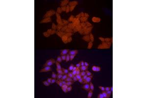 Immunofluorescence analysis of HeLa cells using PSM Rabbit pAb (752) at dilution of 1:50 (40x lens). (PSMA5 anticorps  (AA 1-241))