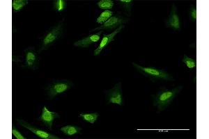 Immunofluorescence of purified MaxPab antibody to MPHOSPH8 on HeLa cell. (MPHOSPH8 anticorps  (AA 1-259))
