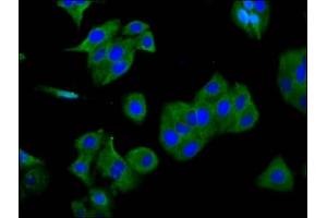 Immunofluorescence staining of HepG2 cells with ABIN7153555 at 1:166, counter-stained with DAPI. (SGCG anticorps  (AA 108-221))