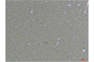 Immunohistochemistry (IHC) analysis of paraffin-embedded Rat Brain Tissue using Kv11.