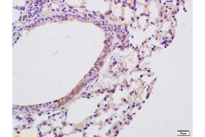 Formalin-fixed and paraffin embedded mouse lung labeled with Anti-IL-9 Polyclonal Antibody, Unconjugated (ABIN740130) at 1:200 followed by conjugation to the secondary antibody and DAB staining (IL-9 anticorps  (AA 21-120))