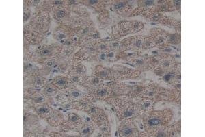 Used in DAB staining on fromalin fixed paraffin- embedded liver tissue (OSTM1 anticorps  (AA 120-251))
