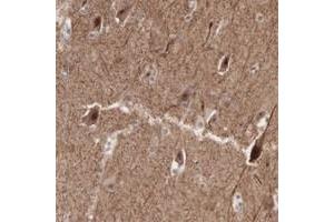 Immunohistochemical staining of human cerebral cortex with ACOT4 polyclonal antibody  shows strong cytoplasmic and nuclear positivity in neuronal cells. (ACOT4 anticorps)
