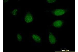 Immunofluorescence of monoclonal antibody to APCS on HeLa cell. (APCS anticorps  (AA 35-149))