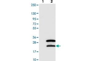 Western blot analysis of Lane 1: Negative control (vector only transfected HEK293T lysate). (SNRNP27 anticorps)