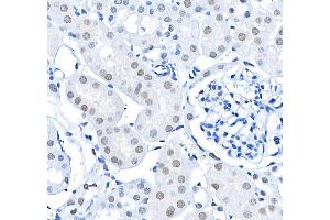 Immunohistochemistry (IHC) image for anti-BMI1 Polycomb Ring Finger Oncogene (BMI1) (AA 250-300) antibody (ABIN7455106)