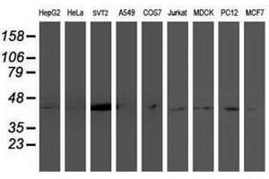 Image no. 2 for anti-NudE Nuclear Distribution E Homolog (A. Nidulans)-Like 1 (NDEL1) antibody (ABIN1499855)