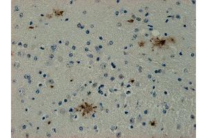 Immunostaining of paraffin embedded sections from mouse brain area containing Alzheimer plaques (dilution 1 : 1000). (SDCBP anticorps)