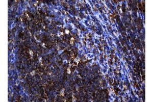 Image no. 1 for anti-SERPINE1 mRNA Binding Protein 1 (SERBP1) (AA 1-262) antibody (ABIN1490674)