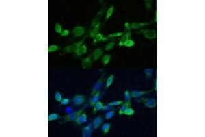 Immunofluorescence analysis of NIH-3T3 cells using SQS/FDFT1 antibody (ABIN6130393, ABIN6140567, ABIN6140568 and ABIN6221824) at dilution of 1:100. (FDFT1 anticorps  (AA 1-260))