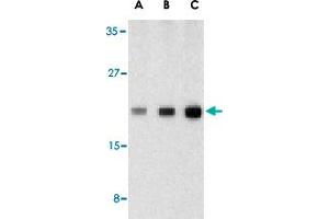 Western blot analysis of CASP1 in human heart tissue lysate with CASP1 polyclonal antibody  at (A) 0. (Caspase 1 anticorps  (C-Term))
