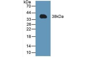 Detection of Recombinant MCL1, Mouse using Polyclonal Antibody to Induced Myeloid Leukemia Cell Differentiation Protein Mcl-1 (MCL1)