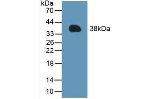 Detection of Recombinant MCL1, Mouse using Polyclonal Antibody to Induced Myeloid Leukemia Cell Differentiation Protein Mcl-1 (MCL1) (MCL-1 anticorps  (AA 2-307))