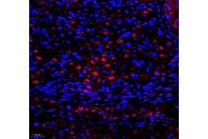 Immunofluorescence of paraffin embedded rat ovary using SNRNP200 (ABIN7075632) at dilution of 1: 650 (400x lens)