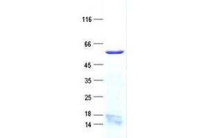 Validation with Western Blot (ELL3 Protein (His tag))