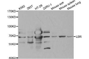 Western Blotting (WB) image for anti-Lamin B Receptor (LBR) antibody (ABIN1876656) (Lamin B Receptor anticorps)