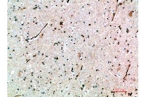 Immunohistochemical analysis of paraffin-embedded human-brain, antibody was diluted at 1:200 (AVPR1B anticorps  (AA 271-320))