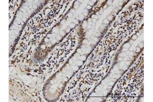 Image no. 1 for anti-Family with Sequence Similarity 3, Member B (FAM3B) (AA 1-236) antibody (ABIN599570) (FAM3B anticorps  (AA 1-236))