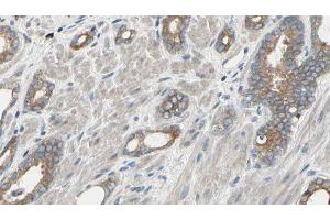 ABIN6277500 at 1/100 staining Human prostate tissue by IHC-P. (EIF4A1 anticorps  (N-Term))
