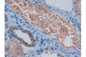 Detection of PKR in Human Kidney Tissue using Polyclonal Antibody to Protein Kinase R (PKR)