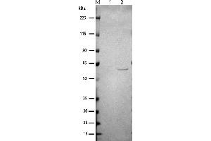 Western blot: anti-Norovirus GI M: Marker 1: (ABIN7538786) VLP_SARS-CoV-2 (S+M+E+N) 2: (ABIN7538804) VLP_Norovirus GI.