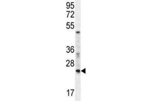 RAN antibody western blot analysis in mouse NIH3T3 lysate. (RAN anticorps  (AA 112-140))