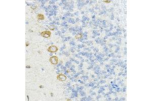 Immunohistochemistry of paraffin-embedded rat cerebellum using LRRC59 Rabbit pAb  at dilution of 1:100 (40x lens).