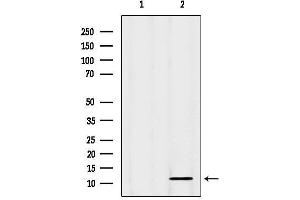 Western blot analysis of lysates from Mouse spleen, using CSTA Antibody.
