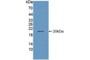 Detection of Recombinant NEP, Human using Polyclonal Antibody to Neprilysin (CD10)