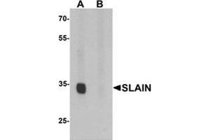 Western blot analysis of SLAIN1 in A549 cell lysate with SLAIN1 antibody at 1 ug/mL in (A) the absence and (B) the presence of blocking peptide. (SLAIN1 anticorps  (C-Term))