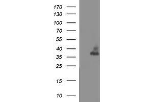 Image no. 3 for anti-Synaptophysin (SYP) antibody (ABIN1501255)