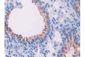 Detection of THBS2 in Mouse Lung Tissue using Polyclonal Antibody to Thrombospondin 2 (THBS2)