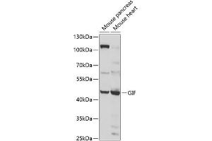 Western blot analysis of extracts of various cell lines, using GIF antibody (ABIN6130975, ABIN6141081, ABIN6141082 and ABIN6222649) at 1:1000 dilution. (Intrinsic Factor anticorps  (AA 20-300))