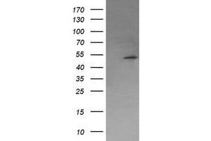 Image no. 5 for anti-Protein Phosphatase, Mg2+/Mn2+ Dependent, 1B (PPM1B) antibody (ABIN1500371) (PPM1B anticorps)
