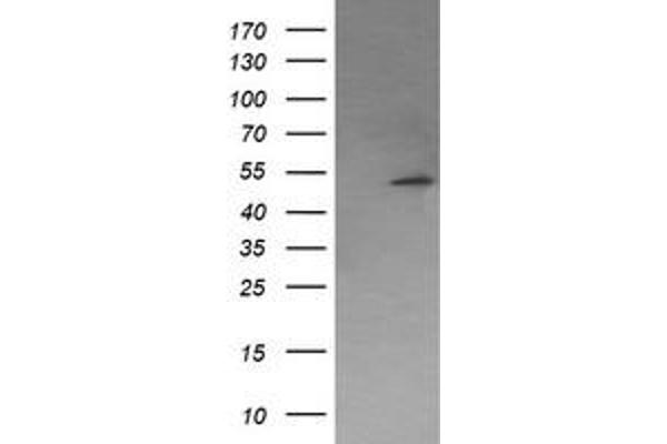 PPM1B anticorps