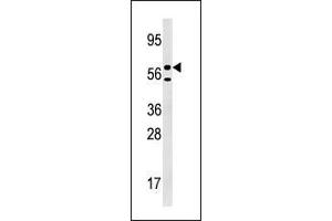 Western blot analysis of anti-URKL1 Pab in 293 cell line lysate (35 µg/lane). (UCKL1 anticorps  (N-Term))