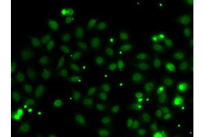 Immunofluorescence analysis of MCF-7 cells using NGFR antibody (ABIN6130898, ABIN6144616, ABIN6144617 and ABIN6223129). (Nerve Growth Factor Receptor (TNFRSF16) Associated Protein 1 (NGFRAP1) (AA 1-111) anticorps)