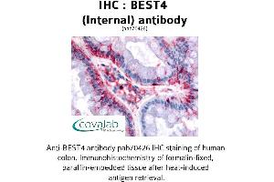 Image no. 1 for anti-Bestrophin 4 (BEST4) (Internal Region) antibody (ABIN1732305) (Bestrophin 4 anticorps  (Internal Region))